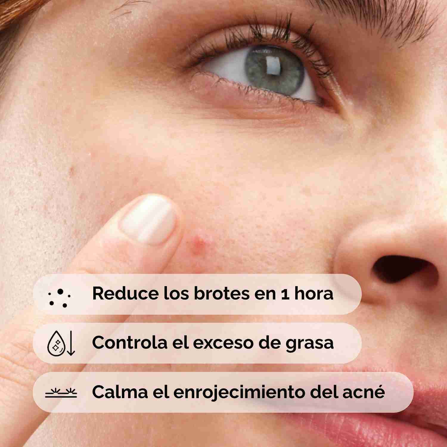 SULFUR 10% POWDER-TO-CREAM CONCENTRATE (CONCENTRADO DE AZUFRE AL 10% EN TEXTURA POLVO A CREMA PARA DISMINUIR BROTES)